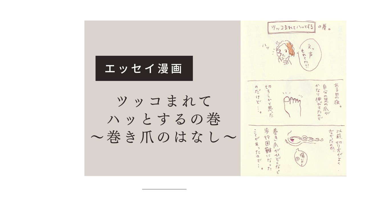【エッセイ漫画】巻き爪治療のはなし