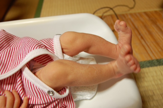 画像 低体重で生まれた赤ちゃんの腕